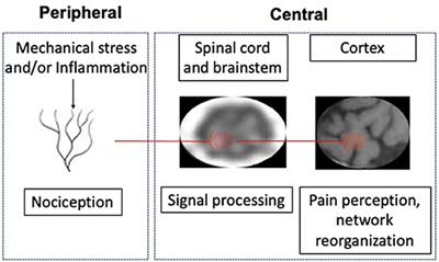 Toward a causal model of chronic back pain: Challenges and opportunities